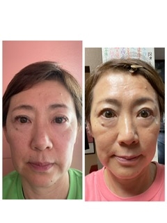 レッスン3カ月後